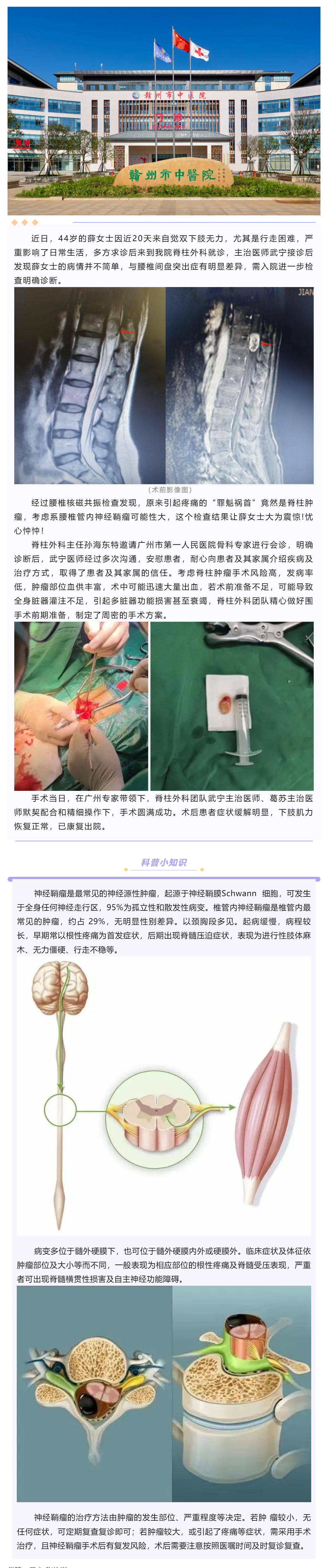 腰腿痛、下肢乏力麻木，提防神经鞘瘤！.png